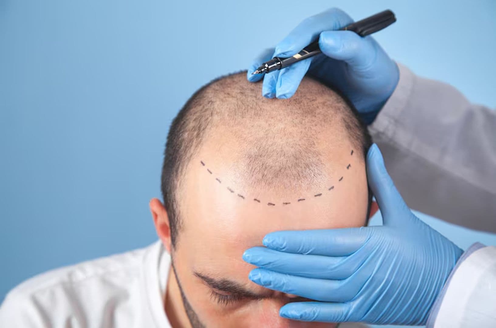 Top Cosmetic Procedures People Are Traveling for in 2025