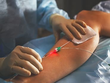 Vascular Surgery